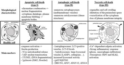 Current Evidence on Cell Death in Preterm Brain Injury in Human and Preclinical Models